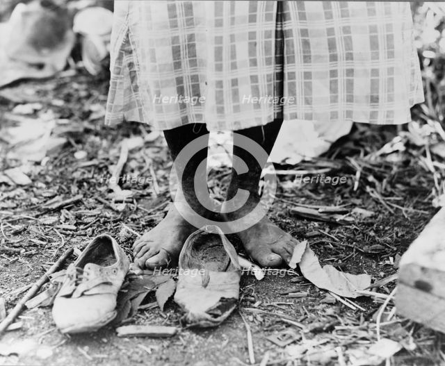 Feet of Negro cotton hoer near Clarksdale, Mississippi, 1937. Creator: Dorothea Lange.
