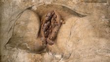 Female genitalia covered with syphilitic warts, c1824. Creator: Unknown