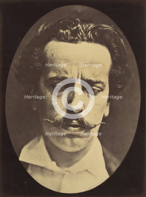 Figure 15: Meditation, mental concentration, 1854-56, printed 1862. Creators: Duchenne de Boulogne, Adrien Alban Tournachon.