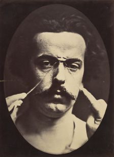 Figure 16: Expression of severity , 1854-56, printed 1862. Creators: Duchenne de Boulogne, Adrien Alban Tournachon