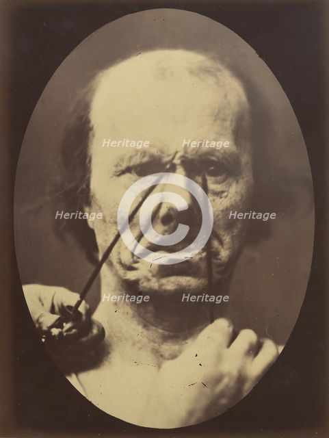 Figure 18: Aggression, wickedness, 1854-56, printed 1862. Creators: Duchenne de Boulogne, Adrien Alban Tournachon.
