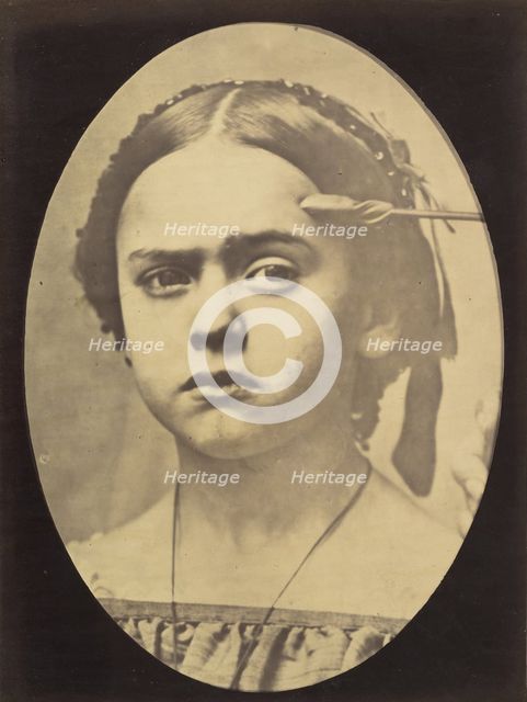 Figure 10: Showing the expressive lines of m. frontalis in a young girl , 1854-56, printed 1862. Creators: Duchenne de Boulogne, Adrien Alban Tournachon.
