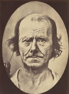 Figure 12: A study of the contraction of and the expression produced by t..., 1854-56, printed 1862. Creators: Duchenne de Boulogne, Adrien Alban Tournachon