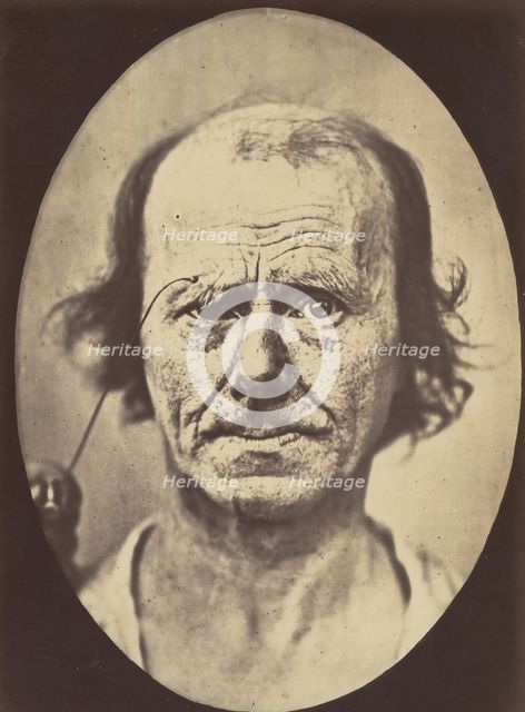 Figure 12: A study of the contraction of and the expression produced by t..., 1854-56, printed 1862. Creators: Duchenne de Boulogne, Adrien Alban Tournachon.