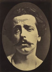 Figure 24: Extreme pain to the point of exhaustion, the head of Christ an..., 1854-56, printed 1862. Creators: Duchenne de Boulogne, Adrien Alban Tournachon