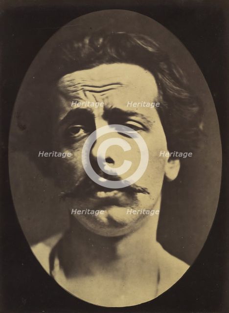 Figure 24: Extreme pain to the point of exhaustion, the head of Christ an..., 1854-56, printed 1862. Creators: Duchenne de Boulogne, Adrien Alban Tournachon.