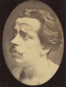 Figure 25: Not an expression of pain, 1854-56, printed 1862. Creators: Duchenne de Boulogne, Adrien Alban Tournachon