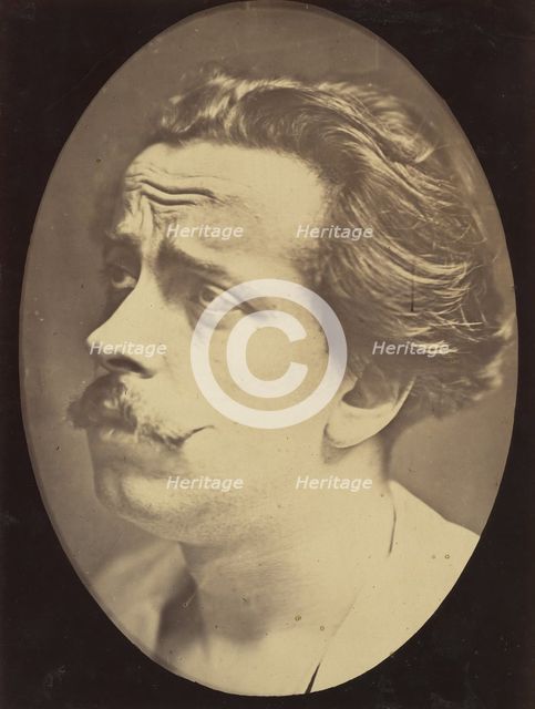 Figure 25: Not an expression of pain, 1854-56, printed 1862. Creators: Duchenne de Boulogne, Adrien Alban Tournachon.