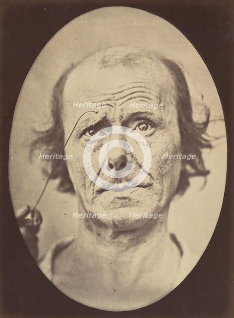 Figure 21: Painful recollection and recollection or calling something to ..., 1854-56, printed 1862. Creators: Duchenne de Boulogne, Adrien Alban Tournachon.