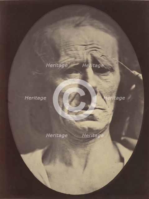 Figure 22: No painful expression , 1854-56, printed 1862. Creators: Duchenne de Boulogne, Adrien Alban Tournachon.