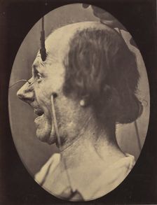 Figure 39: The attention attracted by an object that provokes lascivious ..., 1854-56, printed 1862. Creators: Duchenne de Boulogne, Adrien Alban Tournachon