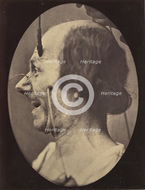 Figure 39: The attention attracted by an object that provokes lascivious ..., 1854-56, printed 1862. Creators: Duchenne de Boulogne, Adrien Alban Tournachon.