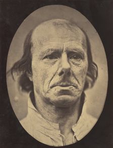 Figure 3: The face of an old man... photographed in repose., 1854-56, printed 1862. Creators: Duchenne de Boulogne, Adrien Alban Tournachon