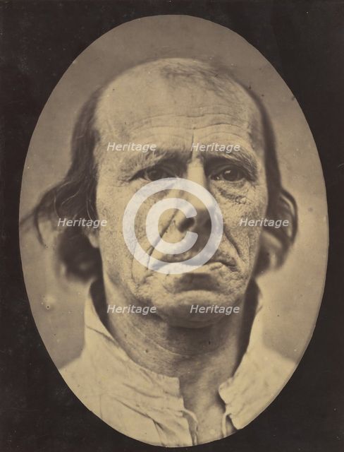 Figure 3: The face of an old man... photographed in repose., 1854-56, printed 1862. Creators: Duchenne de Boulogne, Adrien Alban Tournachon.