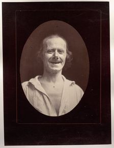 Figure 32: Rire naturel par la contraction volontaire des deux grands zygomatiques..., c. 1856. Creator: Guillaume-Benjamin-Amand Duchenne (de Boulogne) (French, 1806-1875); Adrien Tournachon (French, 1825-1903)