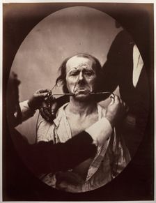 Figure 45: Contraction électrique forte des triangulaires des lèvres et des sourciliers:..., c. 1856 Creator: Guillaume-Benjamin-Amand Duchenne (de Boulogne) (French, 1806-1875); Adrien Tournachon (French, 1825-1903)