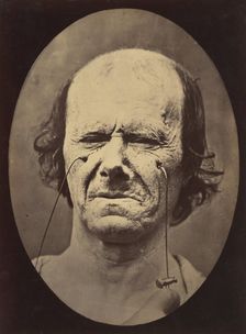Figure 47: A suggestion of this same weeping, 1854-56, printed 1862. Creators: Duchenne de Boulogne, Adrien Alban Tournachon