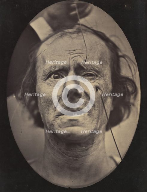 Figure 49: Painful weeping and forward looking., 1854-56, printed 1862. Creators: Duchenne de Boulogne, Adrien Alban Tournachon.