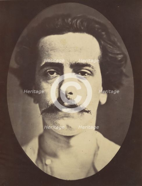 Figure 4: The face in repose of a young man , 1854-56, printed 1862. Creators: Duchenne de Boulogne, Adrien Alban Tournachon.