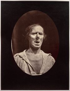 Figure 54: Abaissement volontaire de la mâchoire inférieure: mouvement inexpressif, c. 1856. Creator: Guillaume-Benjamin-Amand Duchenne (de Boulogne) (French, 1806-1875); Adrien Tournachon (French, 1825-1903)