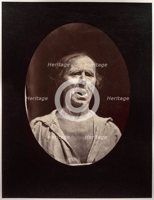 Figure 54: Abaissement volontaire de la mâchoire inférieure: mouvement inexpressif, c. 1856. Creator: Guillaume-Benjamin-Amand Duchenne (de Boulogne) (French, 1806-1875); Adrien Tournachon (French, 1825-1903).
