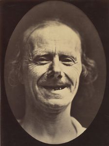 Figure 52: Voluntary retraction of the lower lip, 1854-56, printed 1862. Creators: Duchenne de Boulogne, Adrien Alban Tournachon
