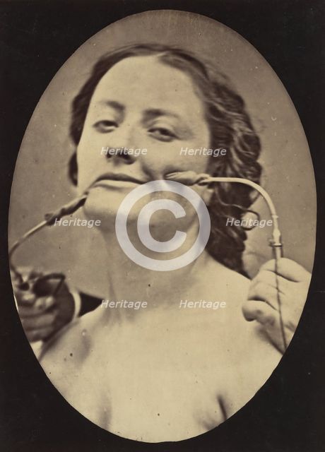 Figure 78: Scene of coquetry, 1854-56, printed 1862. Creators: Duchenne de Boulogne, Adrien Alban Tournachon.