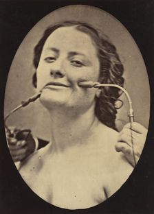 Figure 78: Scene of coquetry, 1854-56, printed 1862. Creators: Duchenne de Boulogne, Adrien Alban Tournachon