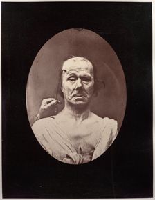 Figure 7: Étude du méchanisme et de lexpression du muscle frontal chez un vieillard: à droit..., c. Creator: Guillaume-Benjamin-Amand Duchenne (de Boulogne) (French, 1806-1875); Adrien Tournachon (French, 1825-1903)