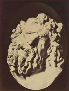 Figure 71: Same head as in Plate 70, 1854-56, printed 1862. Creators: Duchenne de Boulogne, Adrien Alban Tournachon