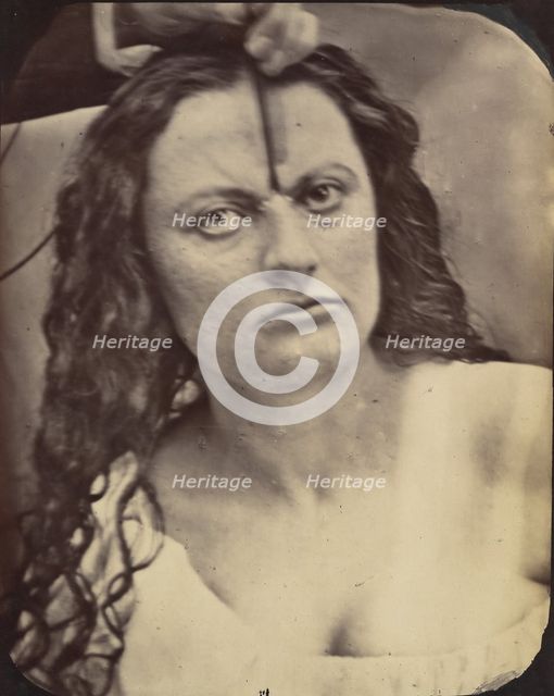 Figure 81: Lady Macbeth, moderate expression of cruelty, 1854-56, printed 1862. Creators: Duchenne de Boulogne, Adrien Alban Tournachon.
