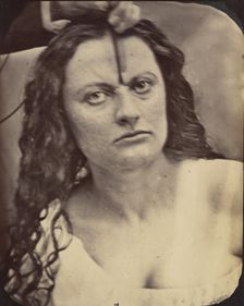 Figure 81: Lady Macbeth, moderate expression of cruelty, 1854-56, printed 1862. Creators: Duchenne de Boulogne, Adrien Alban Tournachon