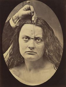 Figure 82: Lady Macbeth, strong expression of cruelty , 1854-56, printed 1862. Creators: Duchenne de Boulogne, Adrien Alban Tournachon