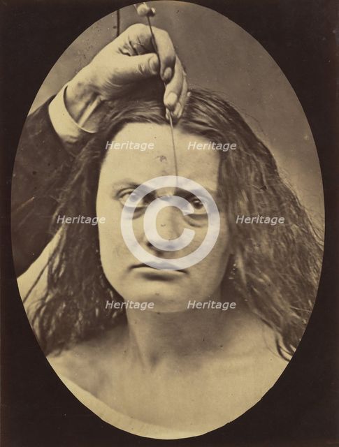 Figure 82: Lady Macbeth, strong expression of cruelty , 1854-56, printed 1862. Creators: Duchenne de Boulogne, Adrien Alban Tournachon.