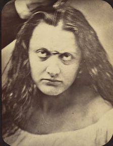 Figure 83: Lady Macbeth, ferocious cruelty, 1854-56, printed 1862. Creators: Duchenne de Boulogne, Adrien Alban Tournachon