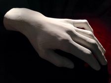 Frédéric Chopin's left hand, 1849