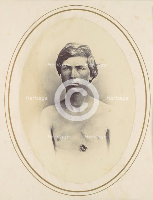 Frederick A. Bentley, 1865. Creator: Reed Brockway Bontecou.