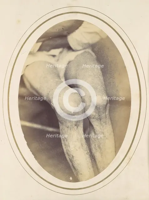 Frederick Hohmann, 1865. Creator: Reed Brockway Bontecou.