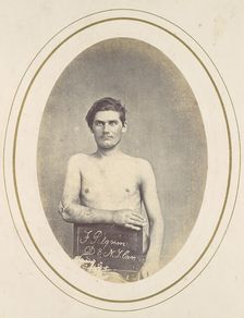 Frederick Pilgrim, 1865. Creator: Reed Brockway Bontecou