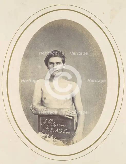 Frederick Pilgrim, 1865. Creator: Reed Brockway Bontecou.