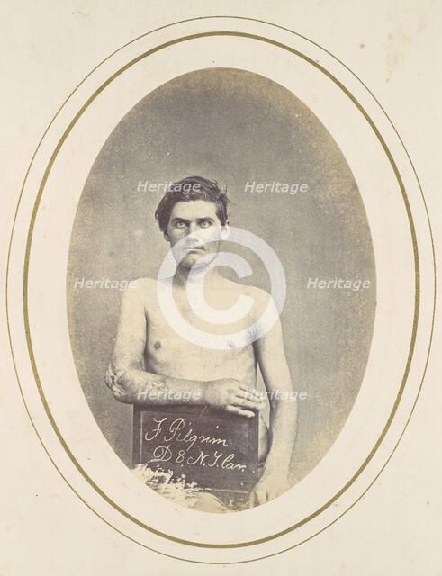 Frederick Pilgrim, 1865. Creator: Reed Brockway Bontecou.