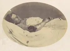Frederick Pilgrim, 1865. Creator: Reed Brockway Bontecou