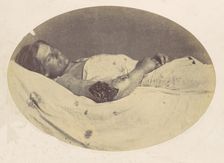 Frederick Pilgrim, 1865. Creator: Reed Brockway Bontecou