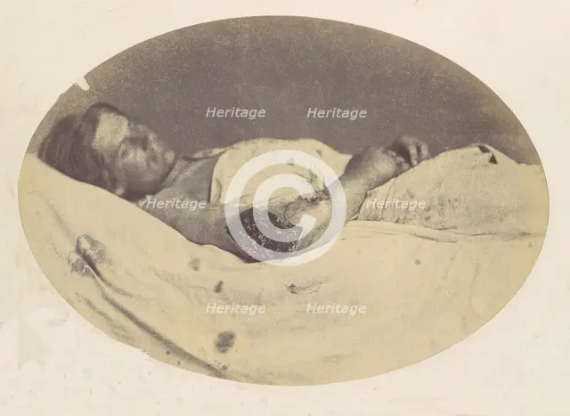 Frederick Pilgrim, 1865. Creator: Reed Brockway Bontecou.