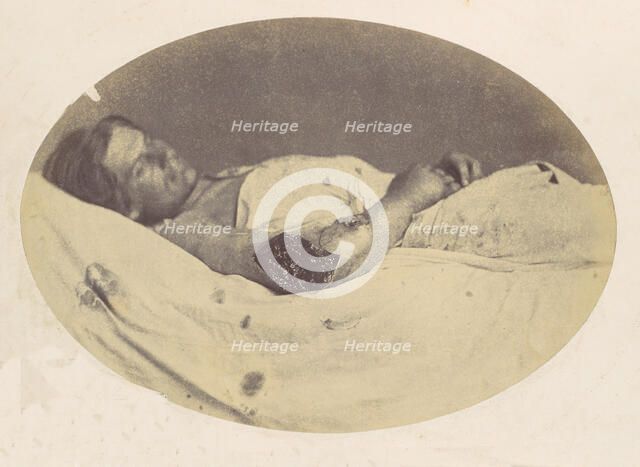 Frederick Pilgrim, 1865. Creator: Reed Brockway Bontecou.