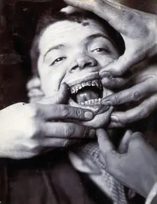 Friern Hospital, London: a boy with rotten teeth, 1890/1910. Creator: Unknown