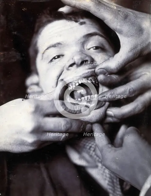 Friern Hospital, London: a boy with rotten teeth, 1890/1910. Creator: Unknown.