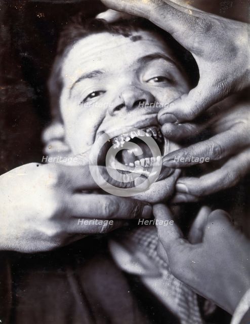 Friern Hospital, London: a boy with rotten teeth, 1890/1910. Creator: Unknown.