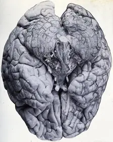Friern Hospital, London: a brain, 1890/1910. Creator: Unknown