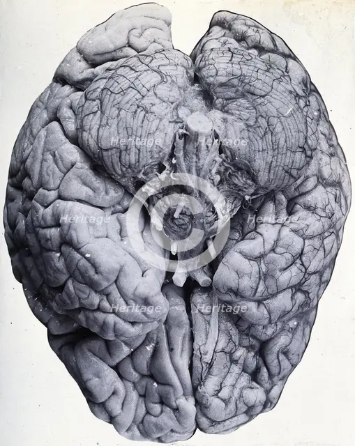 Friern Hospital, London: a brain, 1890/1910. Creator: Unknown.